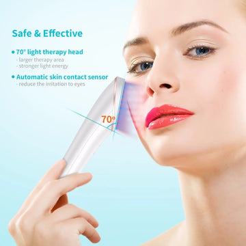 Acne Light Therapy Treatment Device