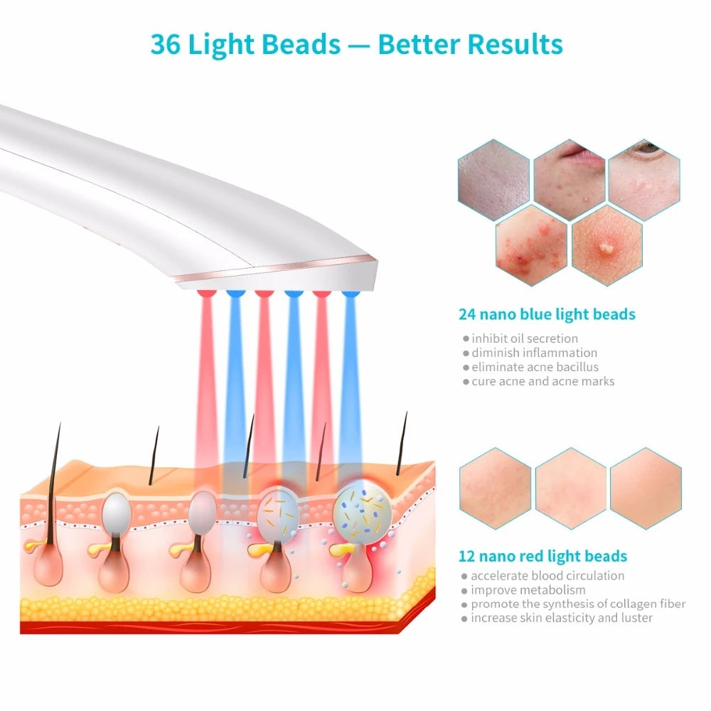 Acne Light Therapy Treatment Device